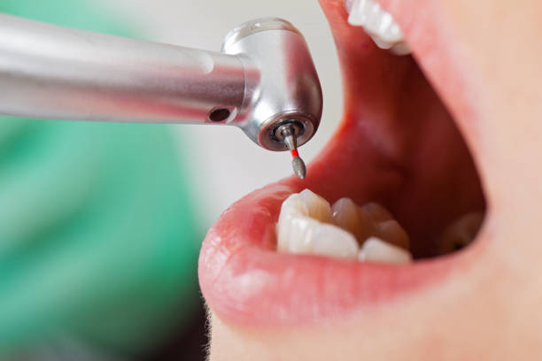 Best Emergency Cosmetic Dentistry (e.g., broken veneers) in Greenville, OH